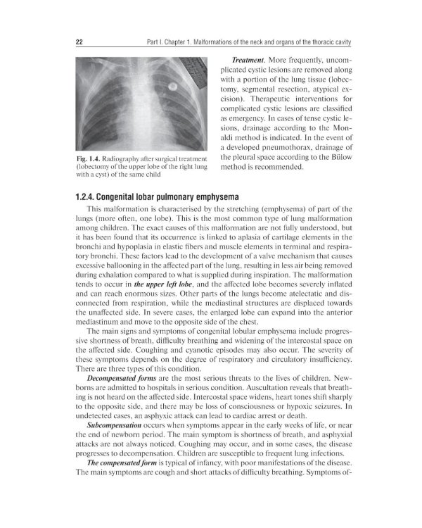 Pediatric surgery : textbook