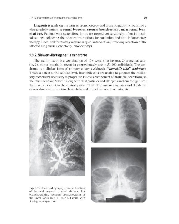 Pediatric surgery : textbook
