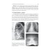 Pediatric surgery : textbook