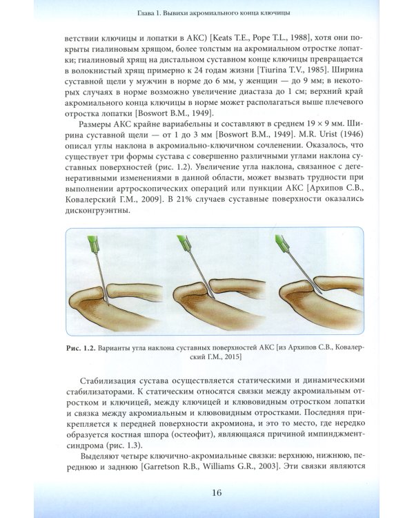 Повреждения ключицы: Учебное пособие