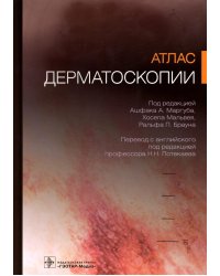Атлас дерматоскопии