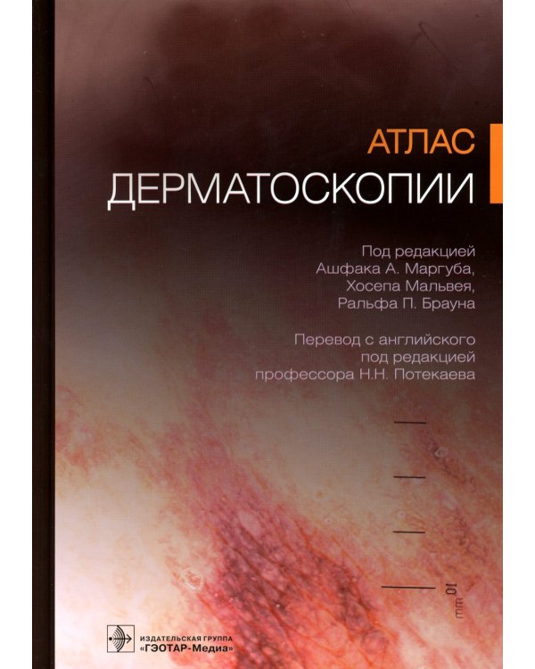 Атлас дерматоскопии