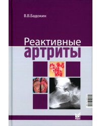 Реактивные артриты. Урогенитальные и постэнтероколитические. 2-е изд