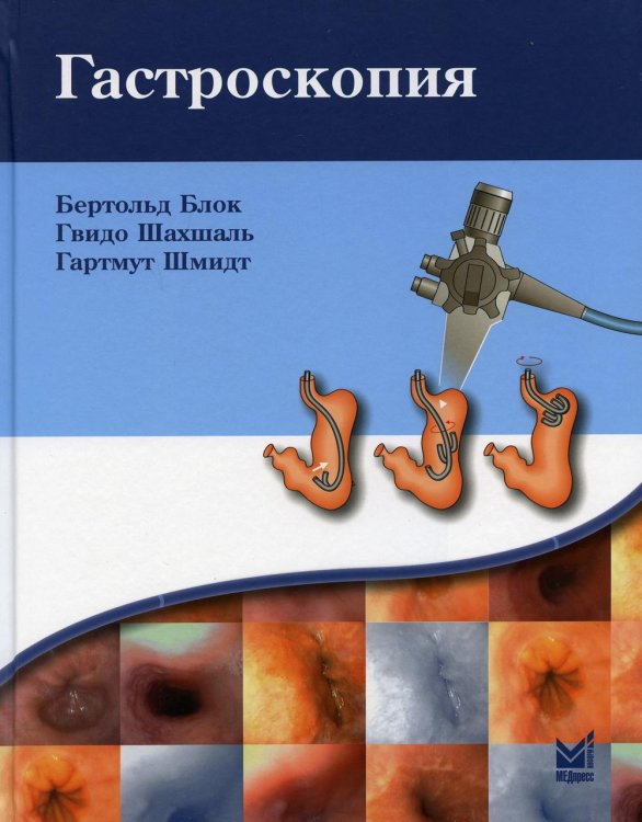 Гастроскопия Гастроскопия
