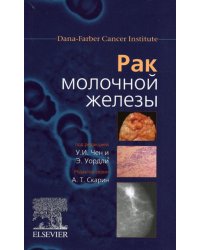 Рак молочной железы