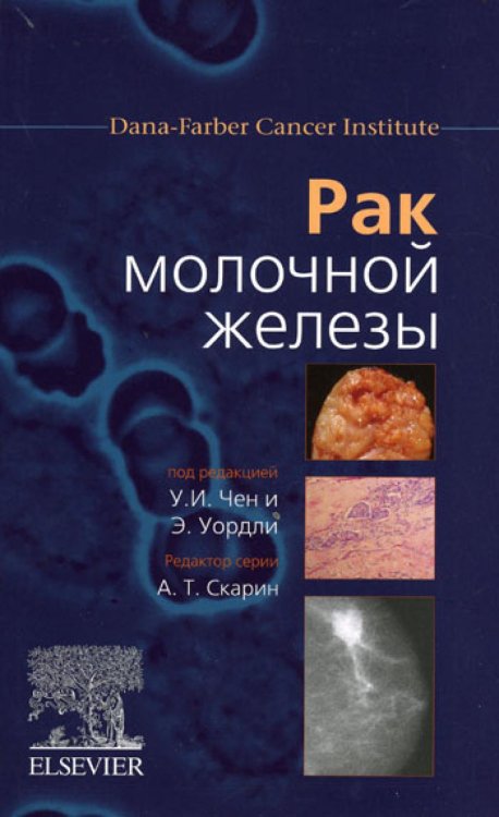 Dana-Farber Cancer Institute Рак молочной железы