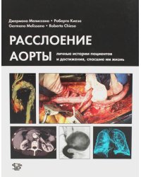 Расслоение аорты. Личные истории пациентов и достижения, спасшие им жизнь