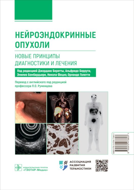 Нейроэндокринные опухоли. Новые принципы диагностики и лечения: руководство для врачей Нейроэндокринные опухоли. Новые принципы диагностики и лечения: руководство для врачей