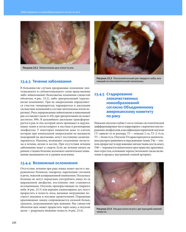 Общая оториноларингология. Хирургия головы и шеи. В 2-х томах (количество томов: 2)