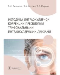 Методика интраокулярной коррекции пресбиопии трифокальными интраокулярными линзами: Учебное пособие