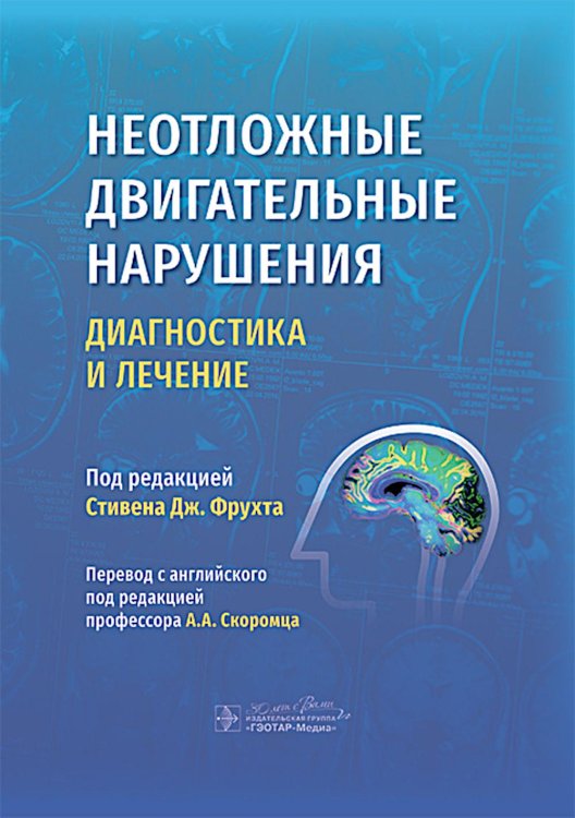 Неотложные двигательные нарушения: диагностика и лечение