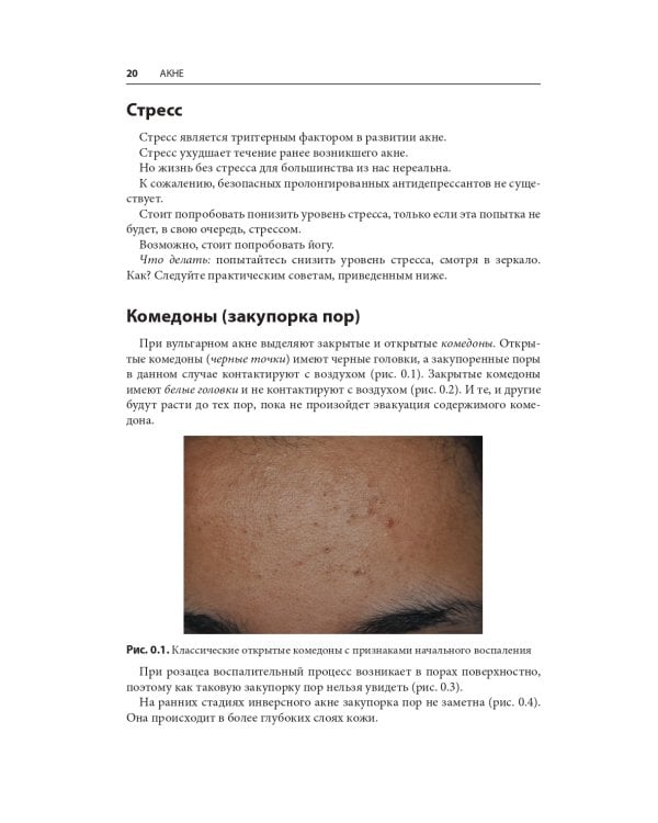 Акне