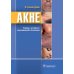 Акне