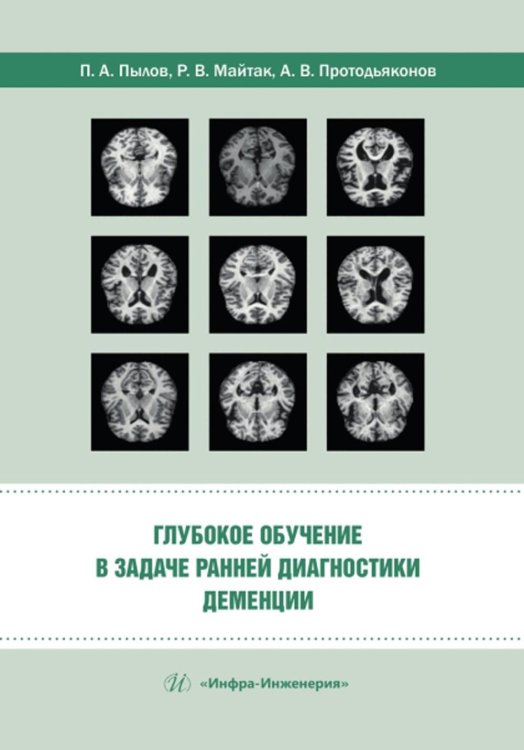 Глубокое обучение в задаче ранней диагностики деменции Глубокое обучение в задаче ранней диагностики деменции