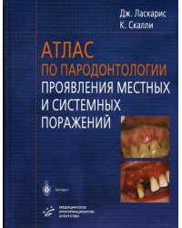 Атлас по пародонтологии. Проявления местных и системных поражений