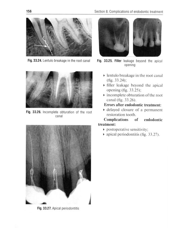 Preclinical course of dentistry: textbook: in 5 parts. Part III. Endodontology = Доклинический курс стоматологии. Ч. 3: Эндодонтия: на англ.яз