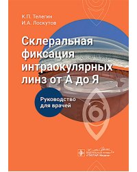 Склеральная фиксация интраокулярных линз от А до Я : руководство для врачей