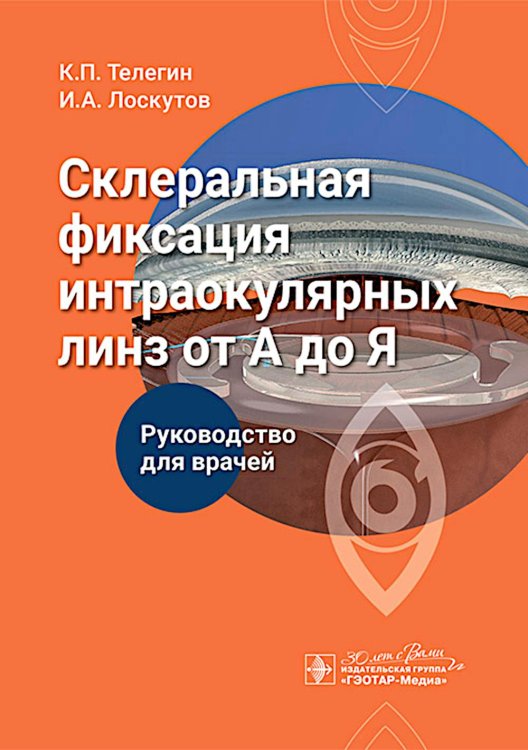 Склеральная фиксация интраокулярных линз от А до Я : руководство для врачей