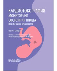 Кардиотокография. Мониторинг состояния плода. Практическое руководство