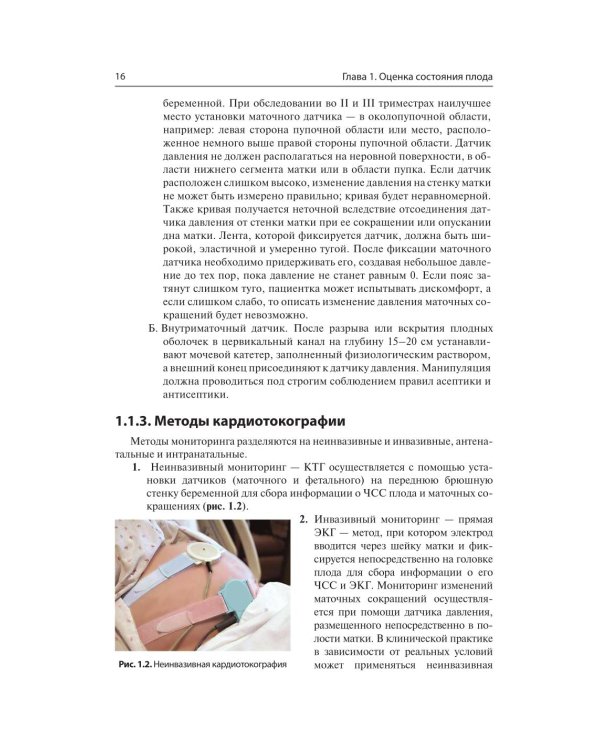 Кардиотокография. Мониторинг состояния плода. Практическое руководство