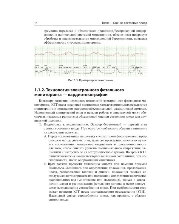 Кардиотокография. Мониторинг состояния плода. Практическое руководство
