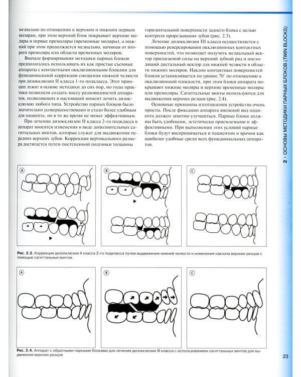 Ортодонтическое лечение парными блоками. 3-е изд