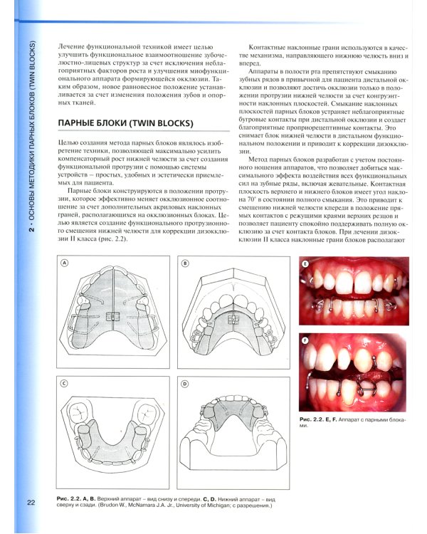 Ортодонтическое лечение парными блоками. 3-е изд