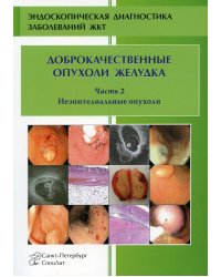 Доброкачественные опухоли желудка. Часть 2. Неэпителиальные опухоли