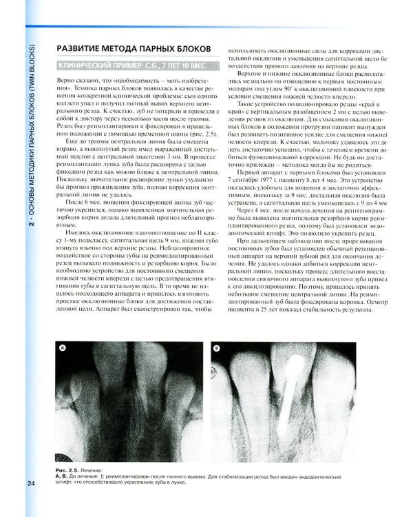 Ортодонтическое лечение парными блоками. 3-е изд