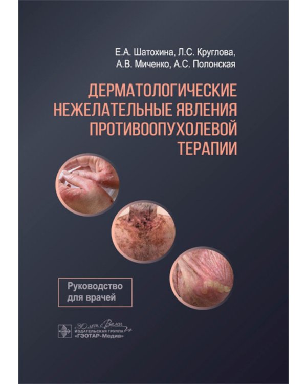 Дерматологические нежелательные явления противоопухолевой терапии: руководство для врачей
