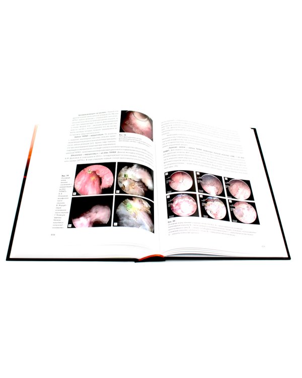 Избранные лекции по урологии