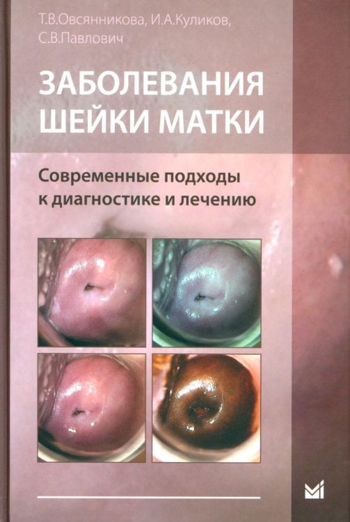 Заболевания шейки матки. Современные подходы к диагностике и лечению: Учебное пособие для врачей Заболевания шейки матки. Современные подходы к диагностике и лечению: Учебное пособие для врачей