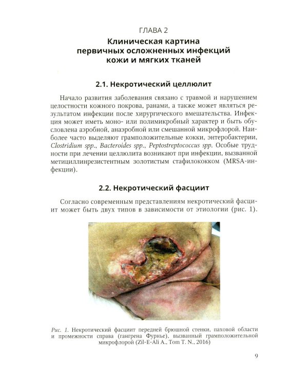 Дополнительное изображение книги «Первичные осложненные инфекции кожи и мягких тканей: учебное пособие»