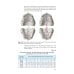 Orthodontics. Modern Methods of Diagnosing Dental Abnormalities, Dentition and Occlusion: tutorial: на англ.яз Orthodontics. Modern Methods of Diagnosing Dental Abnormalities, Dentition and Occlusion: tutorial: на англ.яз