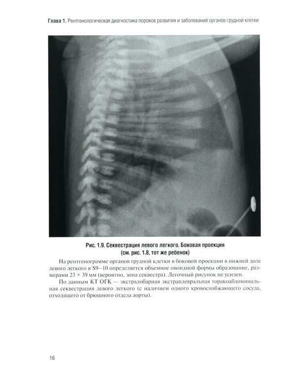 Неотложная рентгенодиагностика в неонатологии и педиатрии (Атлас рентгеновских изображений): Учебное пособие. 2-е изд., доп. и перераб