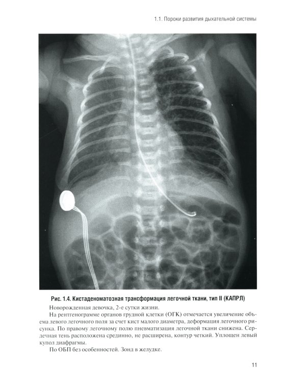 Неотложная рентгенодиагностика в неонатологии и педиатрии (Атлас рентгеновских изображений): Учебное пособие. 2-е изд., доп. и перераб