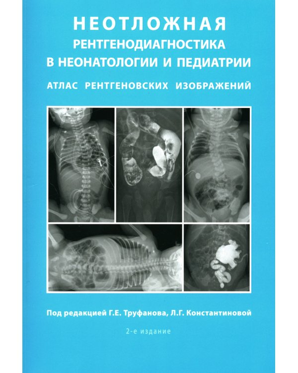 Неотложная рентгенодиагностика в неонатологии и педиатрии (Атлас рентгеновских изображений): Учебное пособие. 2-е изд., доп. и перераб