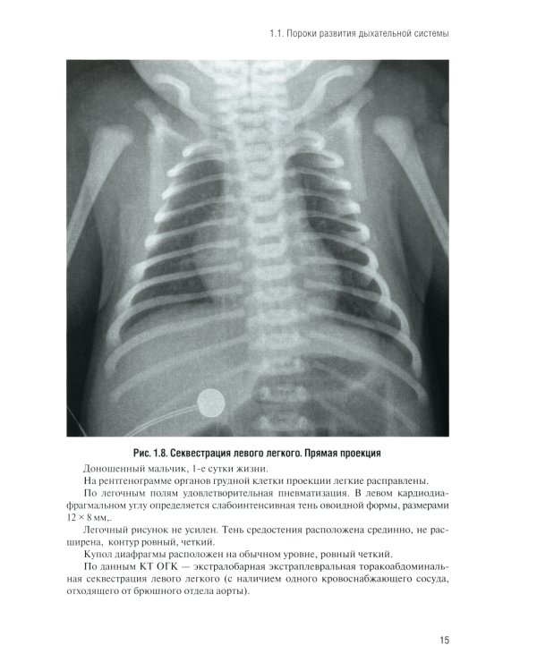 Неотложная рентгенодиагностика в неонатологии и педиатрии (Атлас рентгеновских изображений): Учебное пособие. 2-е изд., доп. и перераб