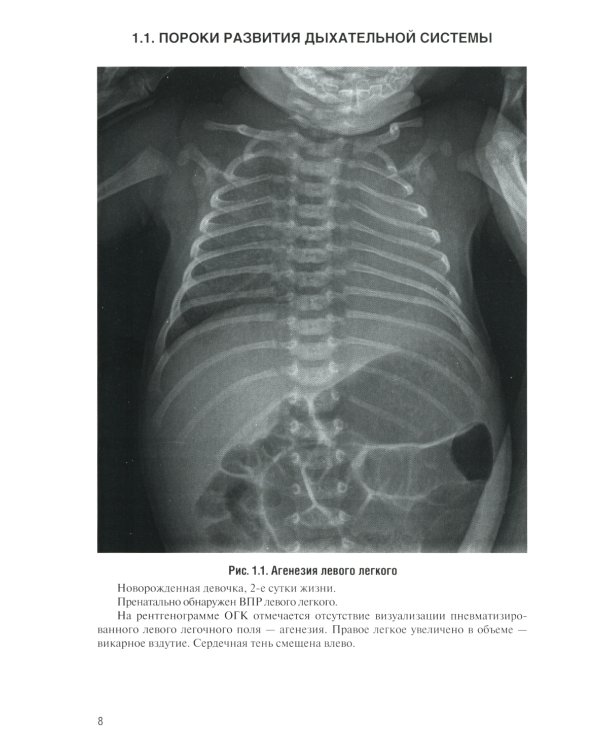 Неотложная рентгенодиагностика в неонатологии и педиатрии (Атлас рентгеновских изображений): Учебное пособие. 2-е изд., доп. и перераб