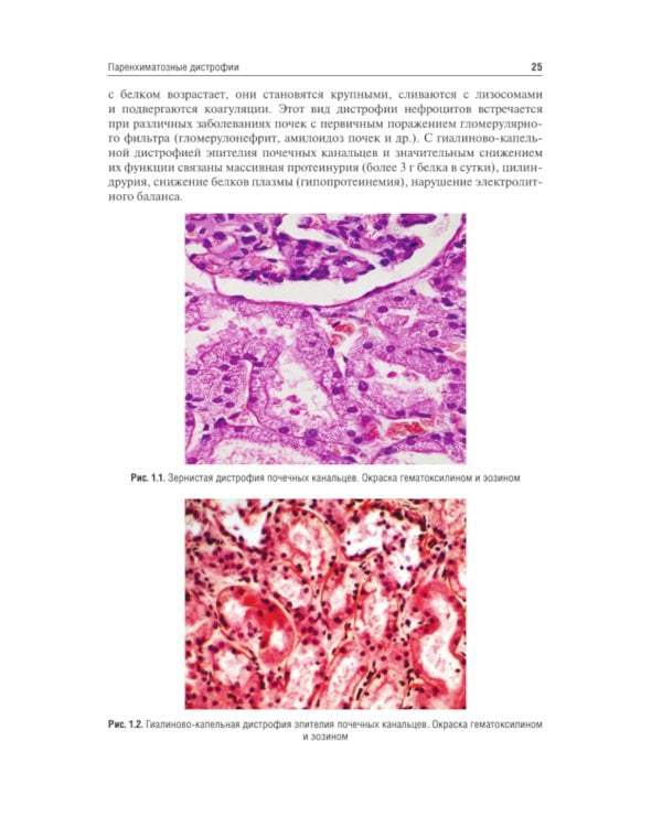 Патологическая анатомия: Учебник. 4-е изд., сокр. и перераб