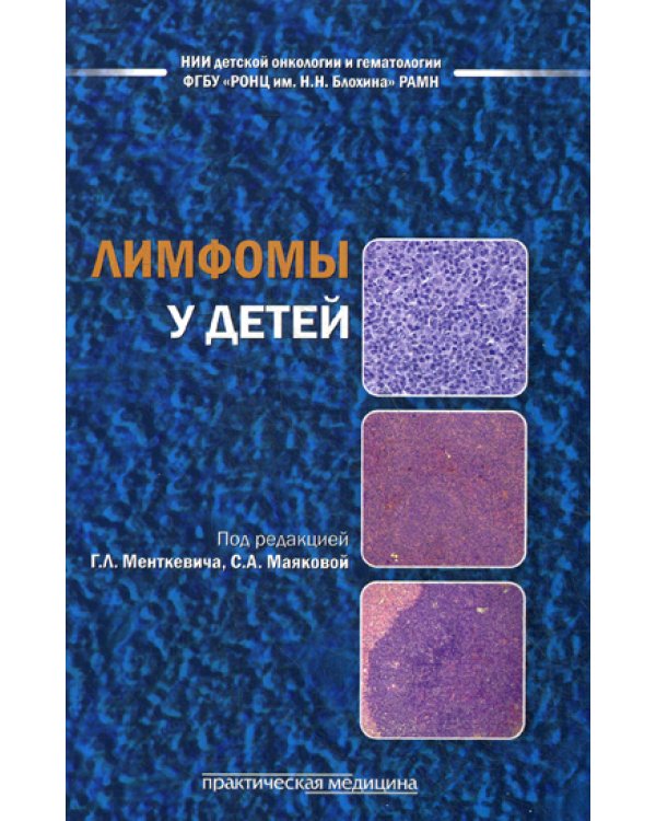 Лимфомы у детей