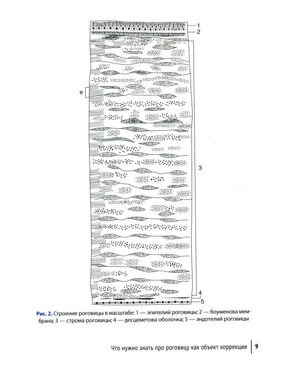 Лазерная коррекция зрения и этот загадочный инновационный метод ReLEx SMILE