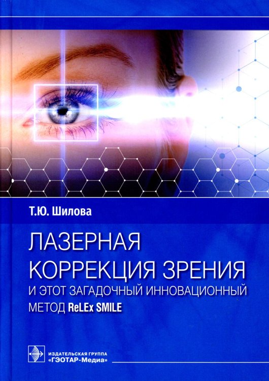 Лазерная коррекция зрения и этот загадочный инновационный метод ReLEx SMILE Лазерная коррекция зрения и этот загадочный инновационный метод ReLEx SMILE