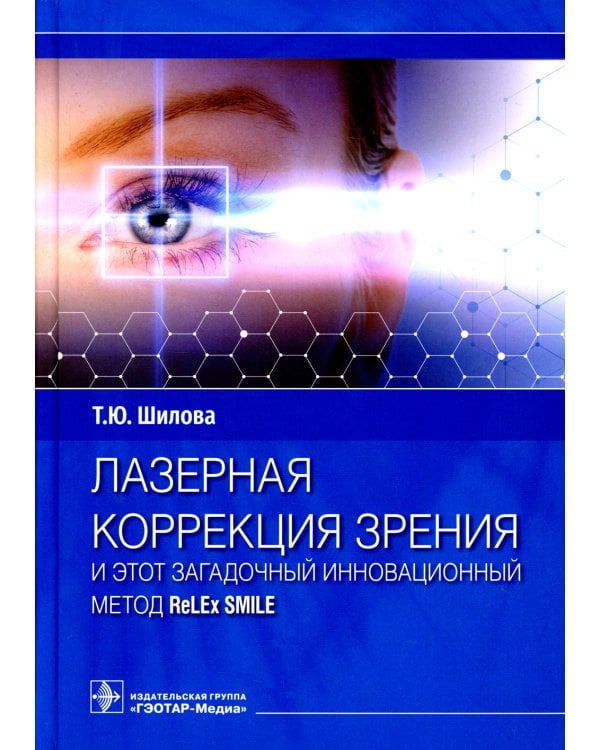 Лазерная коррекция зрения и этот загадочный инновационный метод ReLEx SMILE