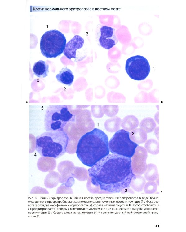 Атлас по гематологии. Практическое пособие по морфологической и клинической диагностике. 4-е изд