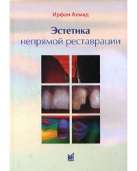 Эстетика непрямой реставрации