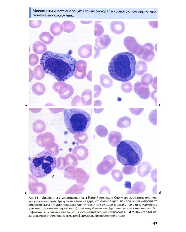 Атлас по гематологии. Практическое пособие по морфологической и клинической диагностике. 4-е изд