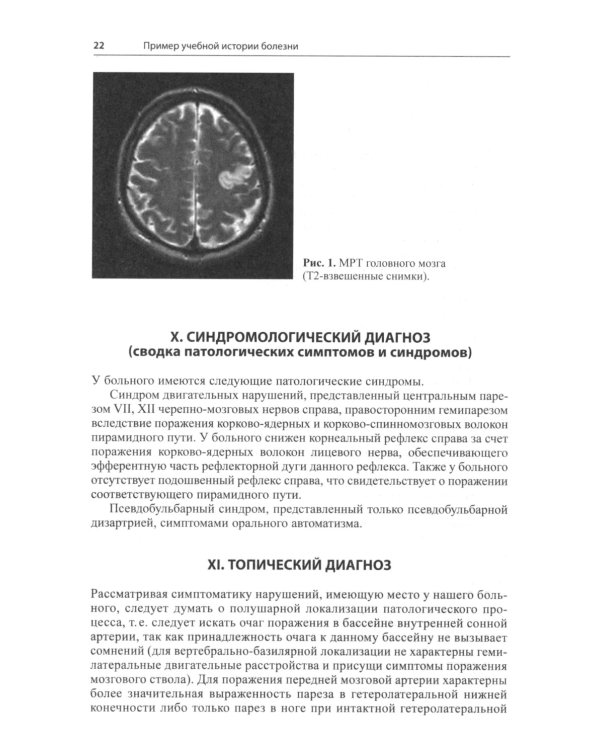 История болезни по неврологии: учебно-методическое пособие. 2-е изд