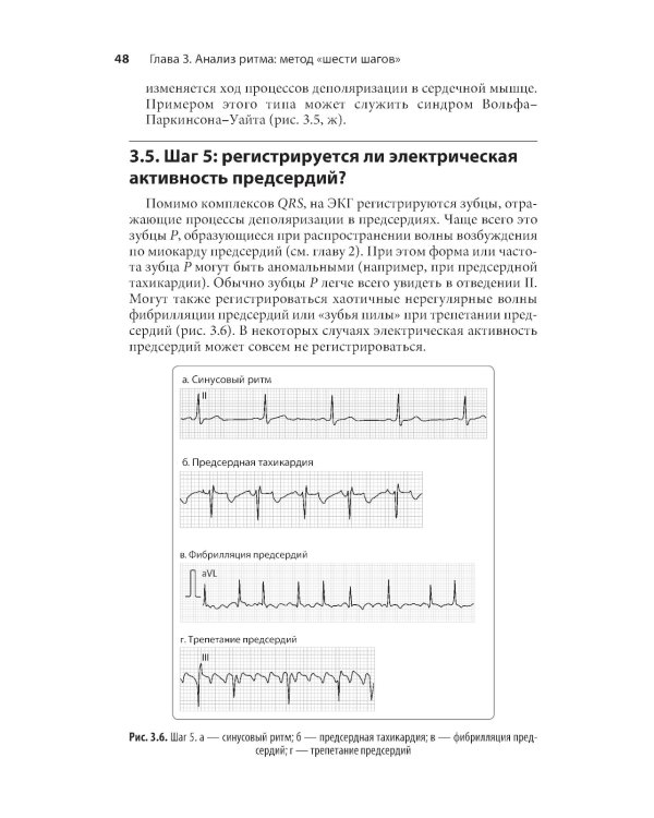 Карманный справочник по ЭКГ. 2-е изд., испр. и доп