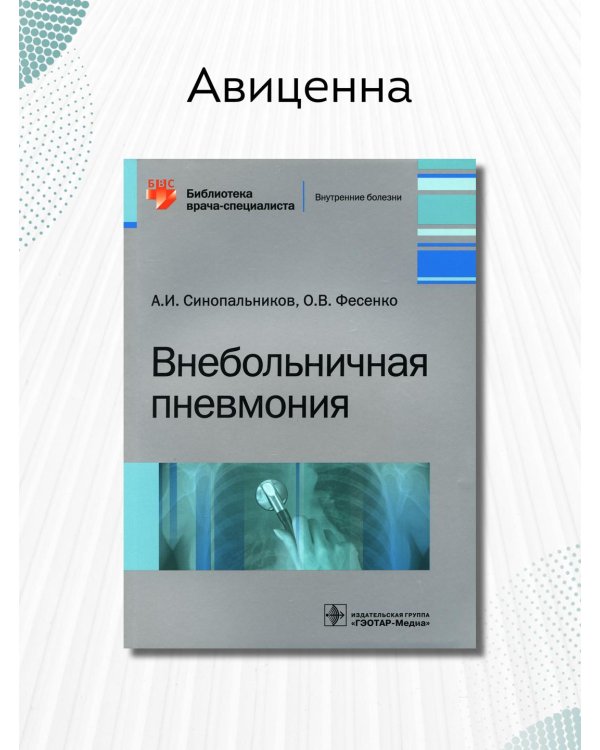 Внебольничная пневмония